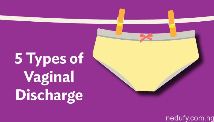 vaginal discharge types