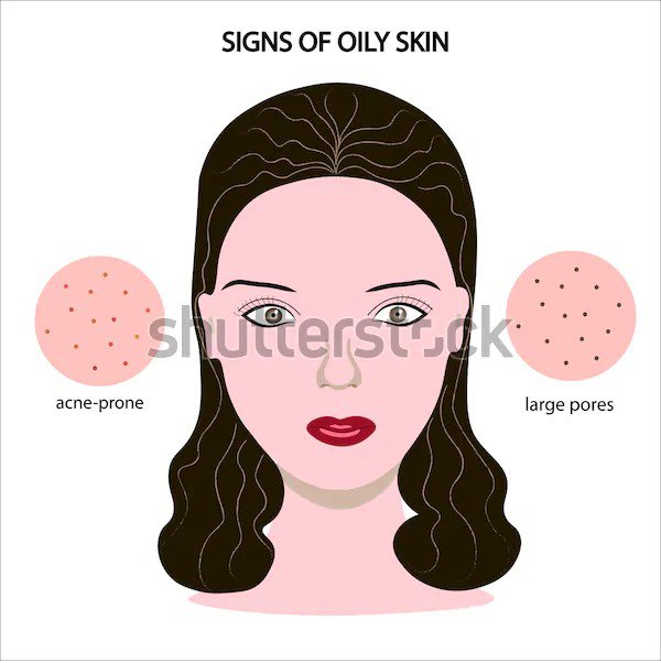 Signs of oily skin