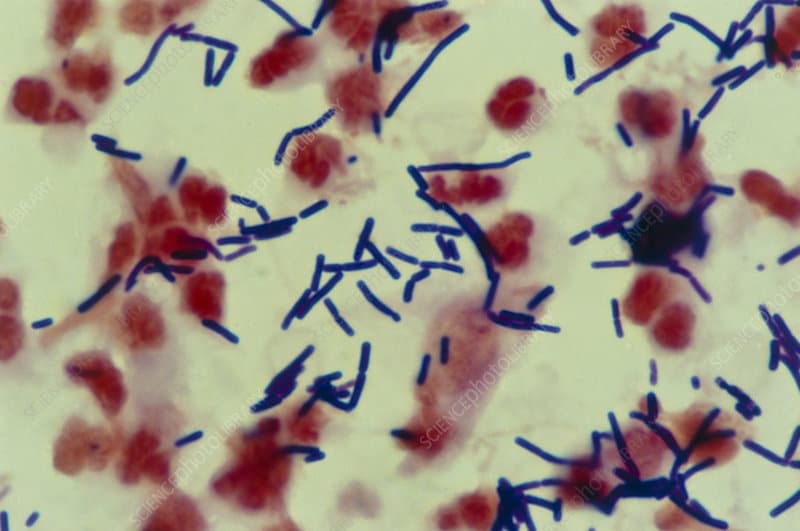Lactobacillus acidophilus in gram stain