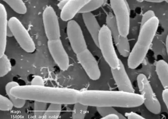 Lactobacillus acidophilus seen using microscope