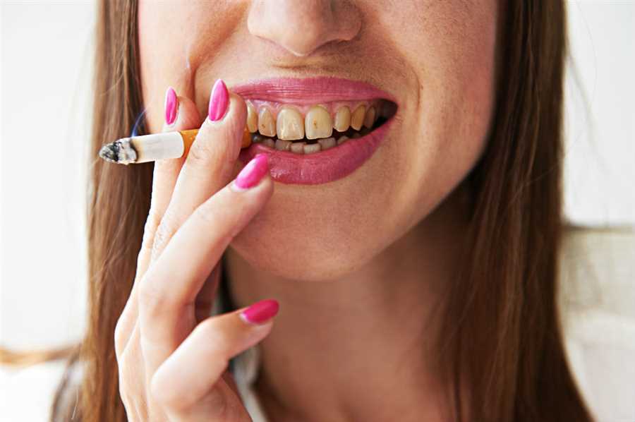 How Long Does It Take For Smoking To Affect Your Teeth?
