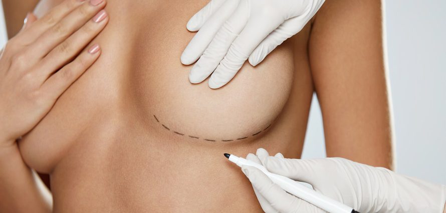 breast cosmetic surgery types