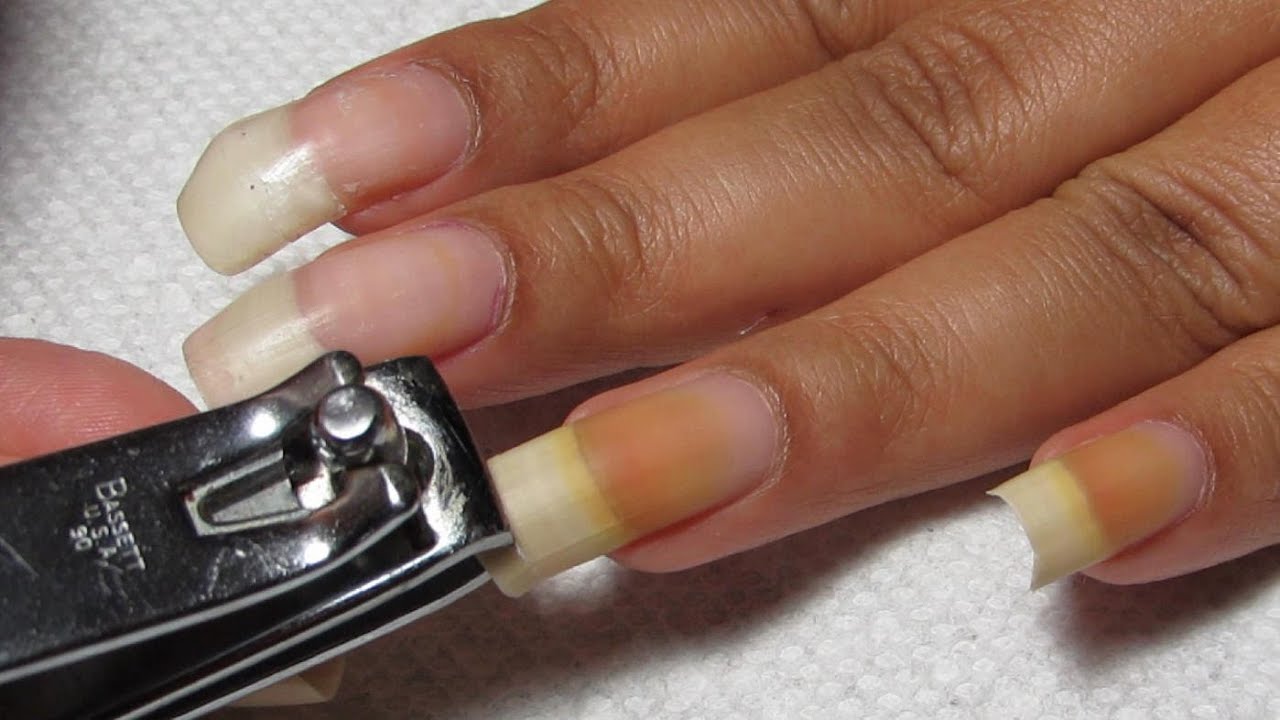 how to stop your nail from growing crooked