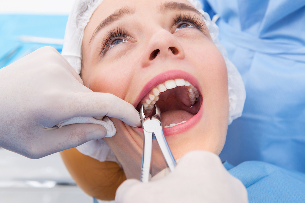 Is Tooth Extraction a Simple Procedure?