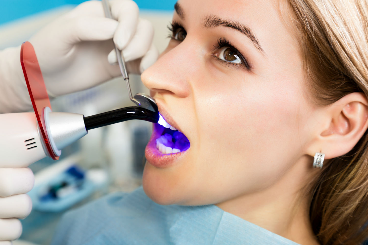 Can You Use Bondic On Teeth?