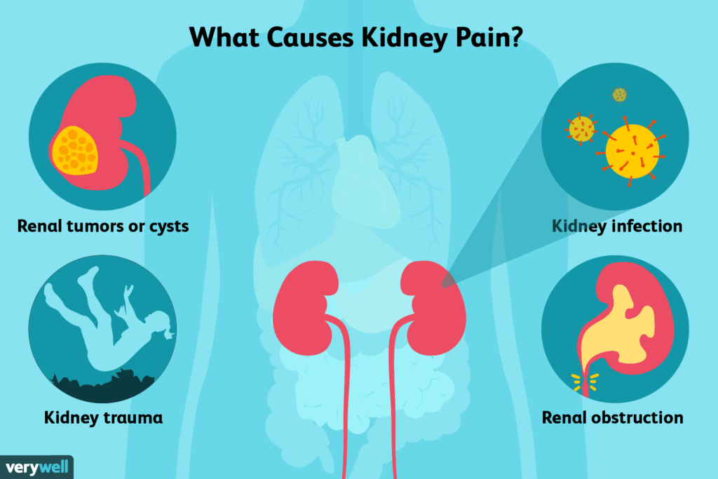Possible Causes of Left Kidney Pain When Coughing