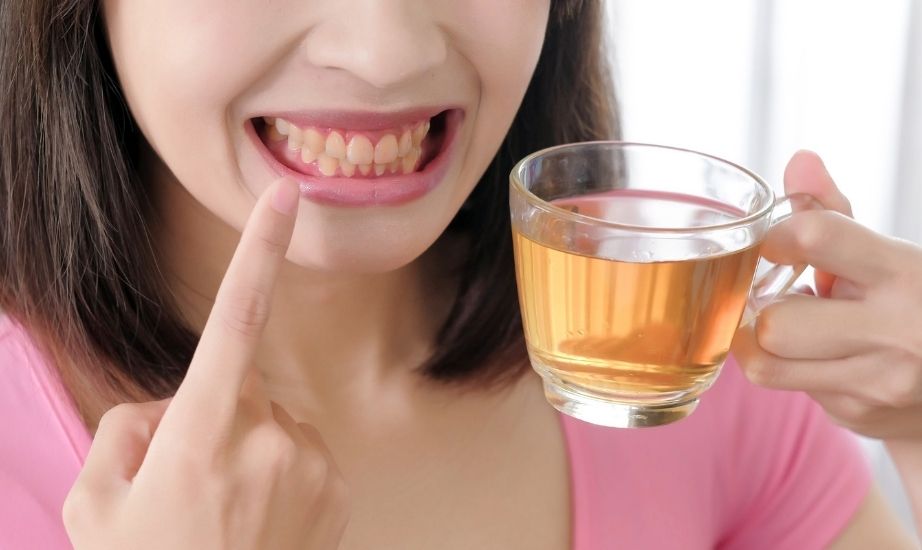 Does Chamomile Tea Stain Teeth?